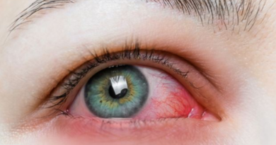 Tensioni i syrit, shenjat kur duhet të shkoni patjetër te mjeku!