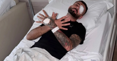 U plagos me plumb gome në sy gjatë protestës, Erjon Vishkulli kalon me sukses operacionin në Romë