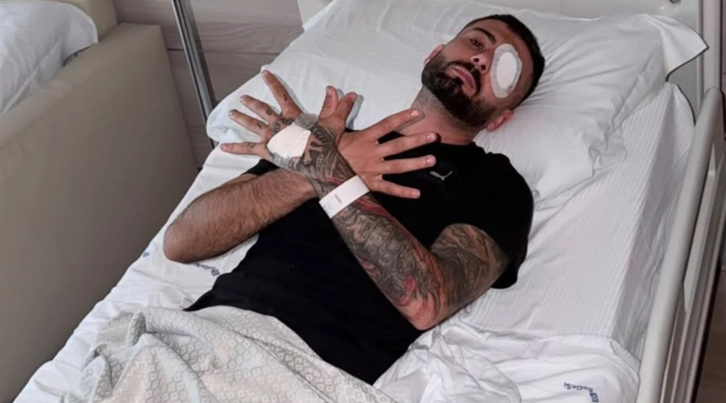U plagos me plumb gome në sy gjatë protestës, Erjon Vishkulli kalon me sukses operacionin në Romë