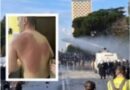 U sulmua me ujë me solucion, gazetari pëson djegie në trup