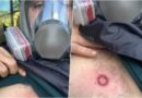 Goditet me plumb gome në zemër. Av Goxhaj: Mercenari më gjuajti me shotgan me shënjestër mu në gjoks!