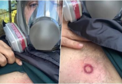 Goditet me plumb gome në zemër. Av Goxhaj: Mercenari më gjuajti me shotgan me shënjestër mu në gjoks!