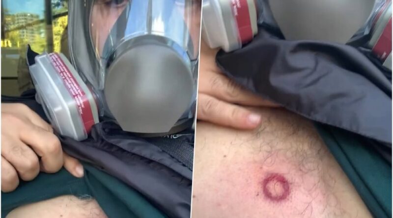 Goditet me plumb gome në zemër. Av Goxhaj: Mercenari më gjuajti me shotgan me shënjestër mu në gjoks!
