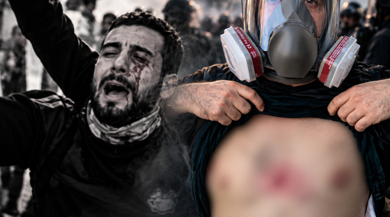 Shkelje e udhëzimeve të OKB-së! Kush mban përgjegjësi për plumbat e gomës në sy e në gjoks?