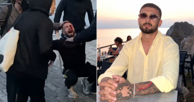 “Më erdhi një goditje, eca dy metra dhe rashë”, Erjon Vishkulli niset drejt Romës për kurim, plumbin e gomës e ka ende në sy