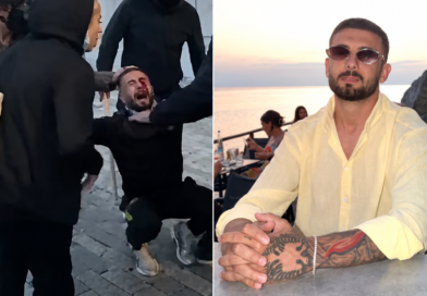 “Më erdhi një goditje, eca dy metra dhe rashë”, Erjon Vishkulli niset drejt Romës për kurim, plumbin e gomës e ka ende në sy