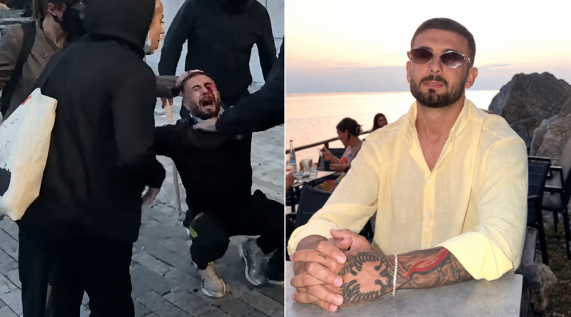 “Më erdhi një goditje, eca dy metra dhe rashë”, Erjon Vishkulli niset drejt Romës për kurim, plumbin e gomës e ka ende në sy